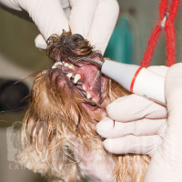 Удаление зубного камня ультразвуковым скалером.