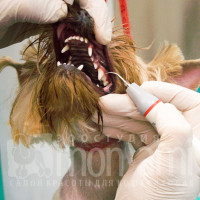 Удаление зубного камня ультразвуковым скалером.